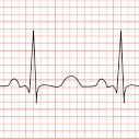 article L'électrocardiogramme (ECG)